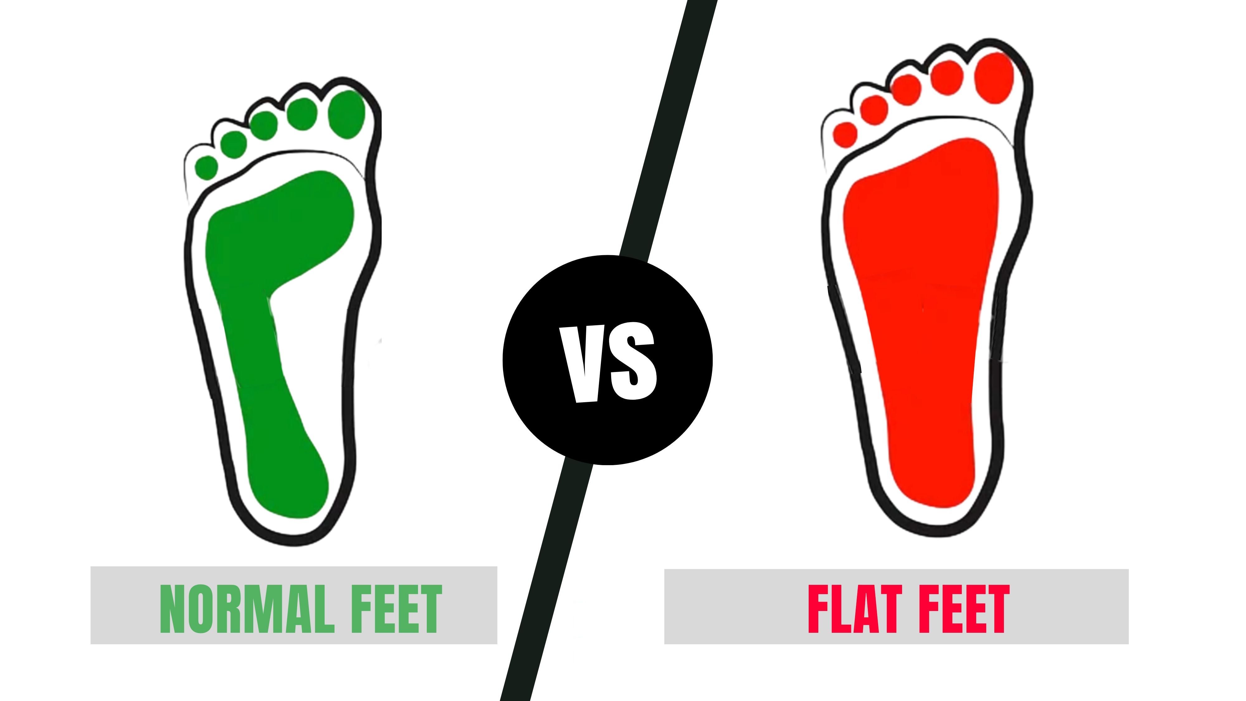 Flat Feet vs Normal Feet